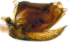 Pygofer, lateral view: (Observation).