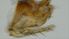 Pygofer, lateral view: (Observation).