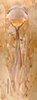 Habitus, dorsal view: Scaphomonus redundans, dorsal habitus (BMNH). (Observation).
