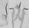 Pygofer lobe, aedeagus, connective, and styli Depicts Other, an Observation.