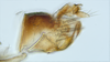 Pygofer, lateral view: (Observation).