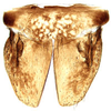 Subgenital plate: Selenocephalus planus, subgenital plates and valve, ventrally (INHS). (Observation).