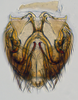 Subgenital plate: (Observation).