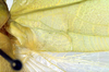CollectionObject 1500358; 882688cc-4ebc-48a3-9519-d9406fbfcfc9, DORSA BTlioaduS01: mirror area, right tegmen (syntype). (CollectionObject).