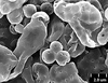 Brochosomes: !! display not done !! on Homalodisca ichthyocephala (Signoret, 1854): HD104 | Mexico | USNM. (Observation).