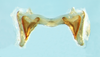 Huaylasacris maxicerci Cigliano, Pocco & Lange, 2011: epiphallus, dorsal view. (Otu).