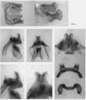 Melanoplus yarrowii (Thomas, 1875): male genitalia. (Otu).