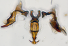 Aedeagus, ventral view on Arawa Knight, 1975 n. sp. 30-83: (Observation).