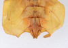 CollectionObject 1561214; feaeeafb-add9-4df9-ad36-79567a93f5eb: copyright ZMUH, Hamburg. female: end of Abdomen, ventral view of Phyllium frondosum (holotype). (CollectionObject).