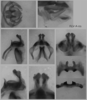 male genitalia. Depicts Melanoplus flabellatus (Scudder, 1878), an Otu.