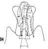 Pygofer, ventral view: (Observation).