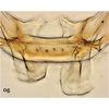 Abdomen, sternal apodemes, ventral view on Bretega orbiverpa Stiller, 2017: Abdomen, sternal apodemes, ventral view. (Observation).