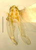 Habitus, dorsal view on Erythridula minuta (Johnson, 1935): Habitus (holotype of E. pecanae Hepner, INHS collection). (Observation).