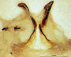 CollectionObject 1505290; b85e406d-308e-4098-8c99-608772f826aa: male titillators (holotype). (CollectionObject).