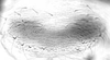 Connective.: Hairs on subgenital plate of A. pomi. (Observation).