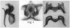 Melanoplus marshallii (Thomas, 1875): male genitalia. (Otu).