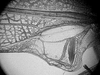 Erioloides latiscobinus Naskrecki & Cohn, 2000: male left mirror area. (Otu).