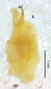CollectionObject 1499379; 7c51828c-b01b-41ef-bf39-75276d63148d: male genitalia, lateral view (holotype). (CollectionObject).