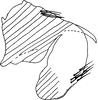 Pygofer, lateral view on Cassianeura aurea Dworakowska, 1980: (Observation).