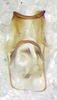 CollectionObject 1523616; cc0ef9bb-1f9c-4083-a25f-db8784b81fe0: male genitalia, dorsal view (holotype). (CollectionObject).