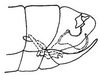 Pygofer, lateral view: !! display not done !! on Polyamia (Copolyamia) interrupta (DeLong, 1916): genital capsule, laterally. (Observation).