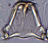 Connective on Coccineasca coccinea (Fitch, 1851): (Observation).