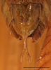 CollectionObject 1588361; 7246837a-206e-488c-a49a-d787314fc7db: male subgenital plate, scale bar 10 mm. (CollectionObject).