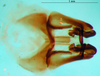 CollectionObject 1501006; 20e3406c-89aa-4f65-8a0b-437deca43e2e: phallic complex, dorsal view (lectoptype). (CollectionObject).