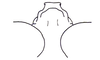 Demochares cristulatus (Stål, 1878): Fig. 95. Vertex of fastigium (dorsal view). (Otu).