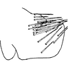 Pygofer, lateral view: Pygofer, lateral view. (Observation).