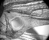 Subria crassicerca Naskrecki & Morris, 2000: male mirror. (Otu).