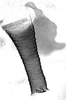 Aedeagus, lateral view.: Siphunculus (SI) of A. gossypii. (Observation).