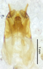 CollectionObject 1523750; 923d7aab-11c5-45ac-bff4-954e3d61f066: male genitalia, dorsal view (holotype). (CollectionObject).