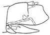 Pygofer, lateral view: !! display not done !! on Scaphoideus (Scaphoideus) luteolus Van Duzee, 1894: genital capsule, laterally. (Observation).