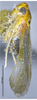 Habitus, lateral view on Arboridia (Arboridia) anteoculara Song & Li, 2013: (Observation).