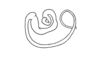 Staleochlora viridicata orientalis Roberts & Carbonell, 1992: Fig. 3D. apical portion of spermatheca. (Otu).