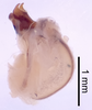 CollectionObject 1522886; fc867b71-6f56-44cf-8576-18718d26c726: Male genitalia, lateral view (holotype). (CollectionObject).