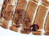 Other on Alocoelidia fulva Evans, 1954: Alocoelidia fulva, internal strepsipteran parasite (CAS). (Observation).