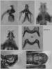 Melanoplus stupefactus (Scudder, 1876): male genitalia. (Otu).
