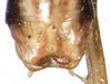 CollectionObject 1597498; 2c29c080-a1e0-4145-9526-e282bae97709: male abdomen tip, dorsal view. (CollectionObject).