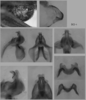 Melanoplus borealis (Fieber, 1853): male genitalia. (Otu).