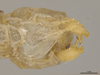CollectionObject 1590425; 9531c51c-3f29-4cd2-9eb3-53287efb6dc0, MPEGMPEG ORT 16017606: male, terminalia ventral view (holotype). (CollectionObject).