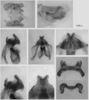 Melanoplus yarrowii (Thomas, 1875): male genitalia. (Otu).
