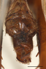 CollectionObject 1586784; e7f7ca5b-c24a-433f-8782-ade3bd7c1dba: abdominal apex, scale bar = 2 mm. (CollectionObject).