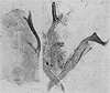 Other: Pygofer lobe, aedeagus, connective, and styli. (Observation).