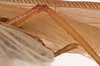 CollectionObject 1534702; f6a49883-4a52-4f0c-8e85-2f41d2782e43: male cerci (syntype of Mataeus longipennis). (CollectionObject).