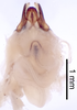 CollectionObject 1522825; acd5b3c7-da1a-4daa-927c-9946a1473a30: Male genitalia, dorsal view (holotype). (CollectionObject).