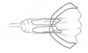 Syntomacrella guyanensis guyanensis (Descamps & Amédégnato, 1970): Fig. 47. spermatheca base. (Otu).