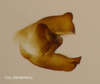 Pygofer, dorsal view on Aphrophora (Plesiommata) irrorata Ball, 1899: (Observation).