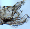 Pygofer, lateral view: (Observation).
